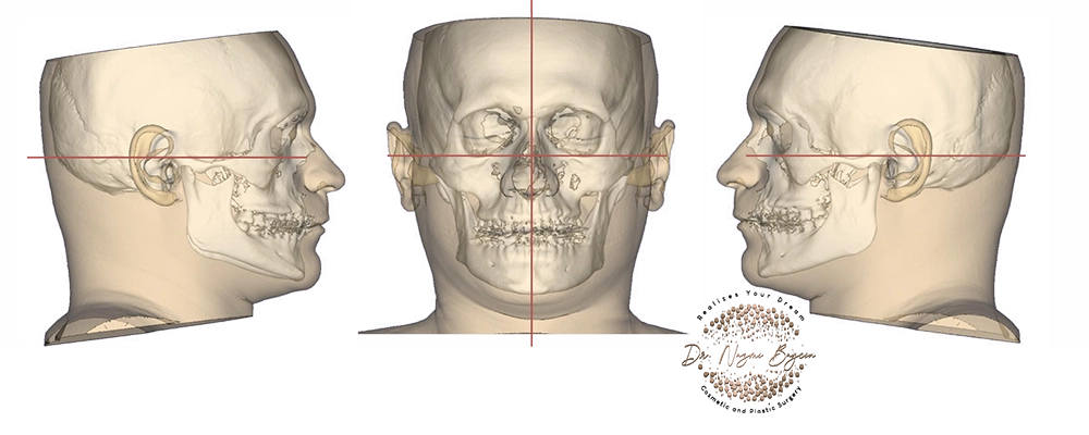 facial bone analysis in dubai